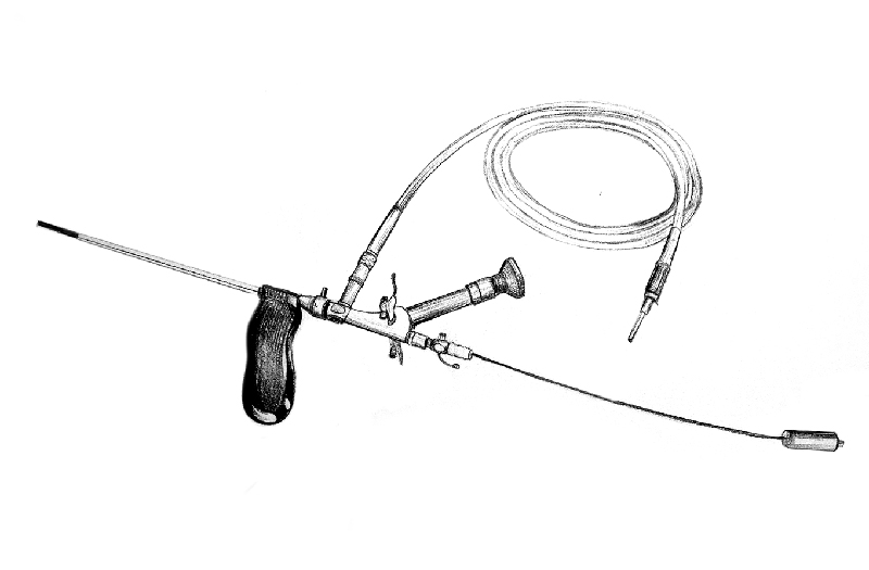 Fistuloscopio